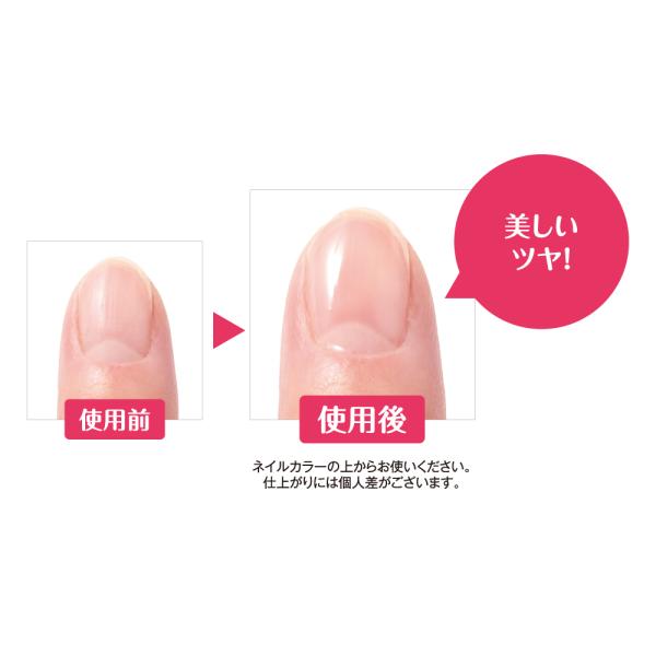 ネイリスト クイッククリスタルコートⅡ